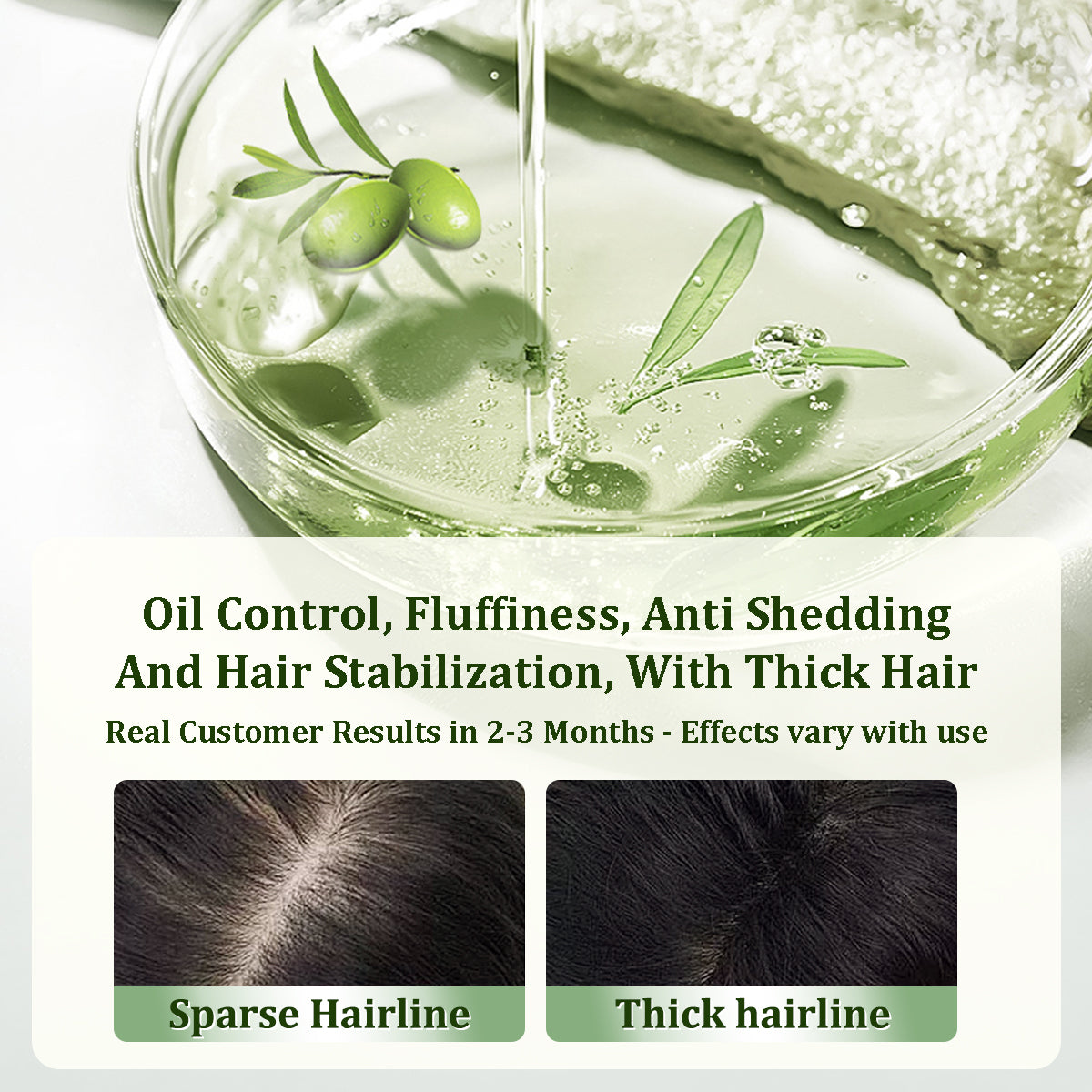 Gypsophila® ACEITE DE BATANA PARA EL CRECIMIENTO DEL CABELLO