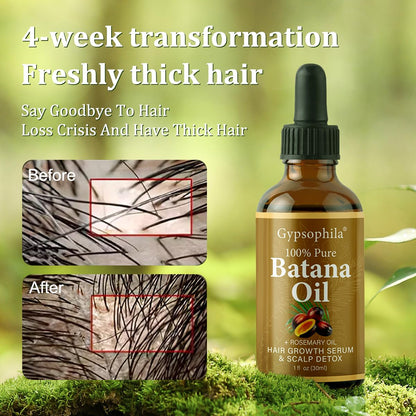 Gypsophila® CHAMPÚ BATANA Y ACEITE DE BATANA Y MASCARILLA CAPILAR - JUEGO DE COMBO