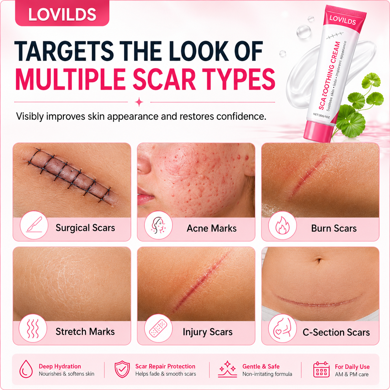 🔥LAST DAY Buy 1 Get 1 Free🔥Scar free wart removal cream