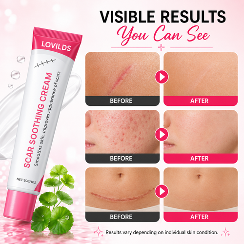 🔥LAST DAY Buy 1 Get 1 Free🔥Scar free wart removal cream